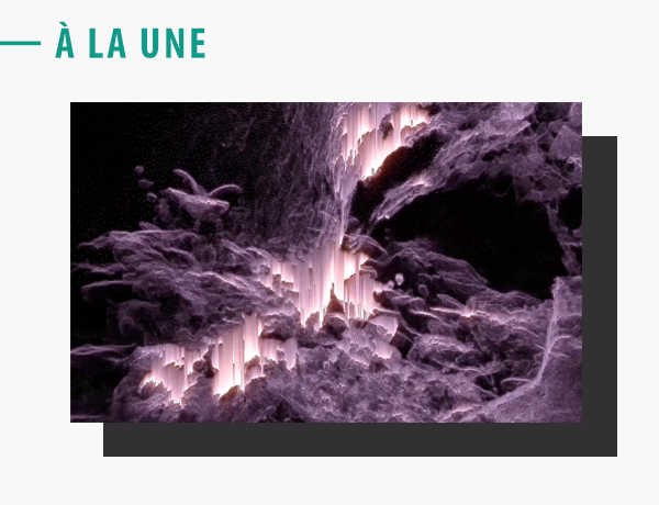 une_aap